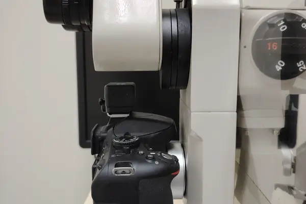 The slit lamp and camera we use to examine and photograph the eye
